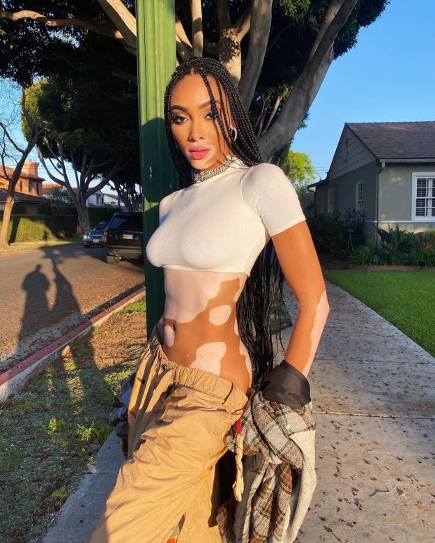 Winnie Harlow Shows That The Quarantine Didn't Affect Her Sexy Figure At All