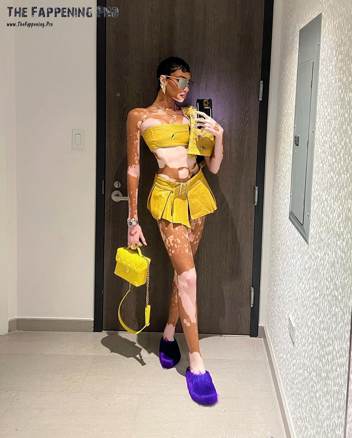 Winnie Harlow Leggy