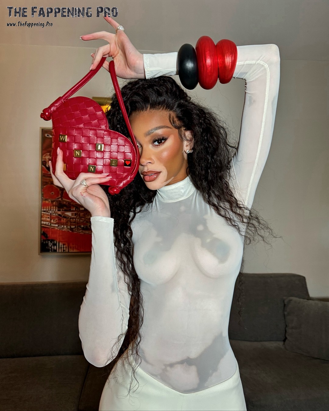 Winnie Harlow Exposed Tits With Vitiligo