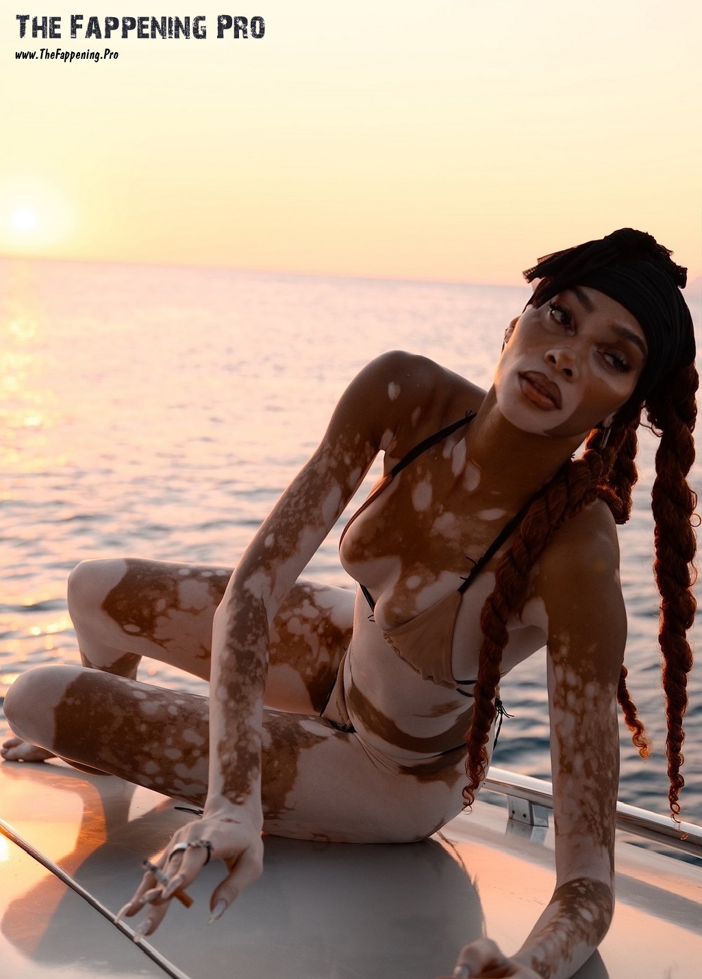 Winnie Harlow TheFappening