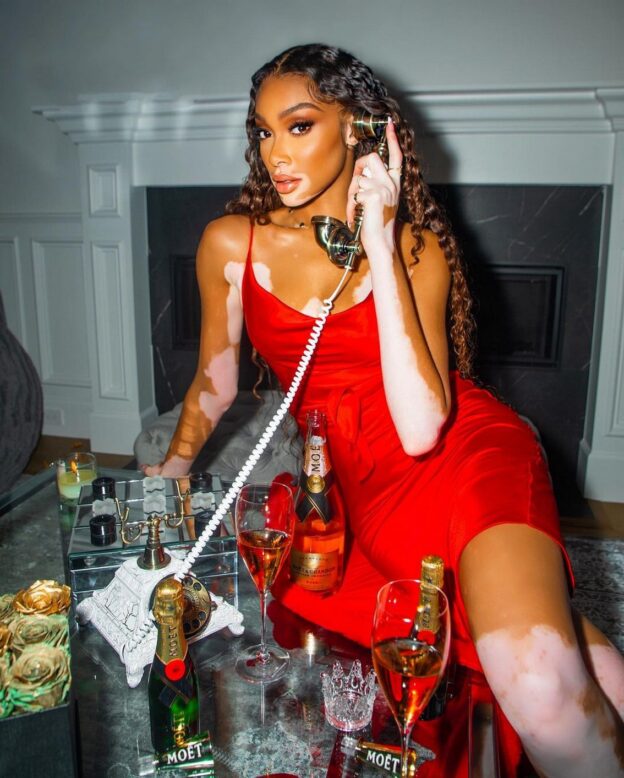 Winnie Harlow Sexy